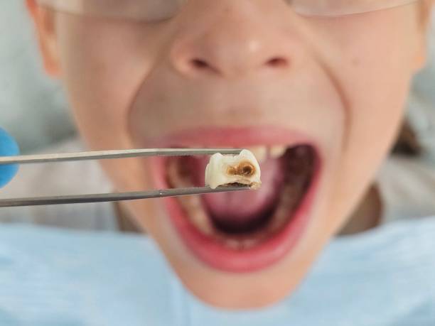 Best Emergency Dental Care for Trauma or Injury in Covington, VA