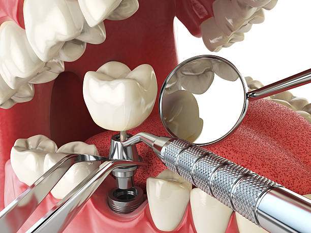Best Urgent Dental Care in Covington, VA