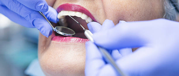 Best Emergency Treatment for Toothache in Covington, VA